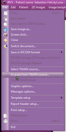 Acquire from TWAIN source